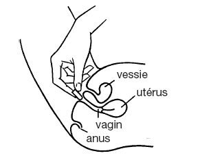 Gyno Canesten Combipack Mycoses Vaginales Abilis Ch